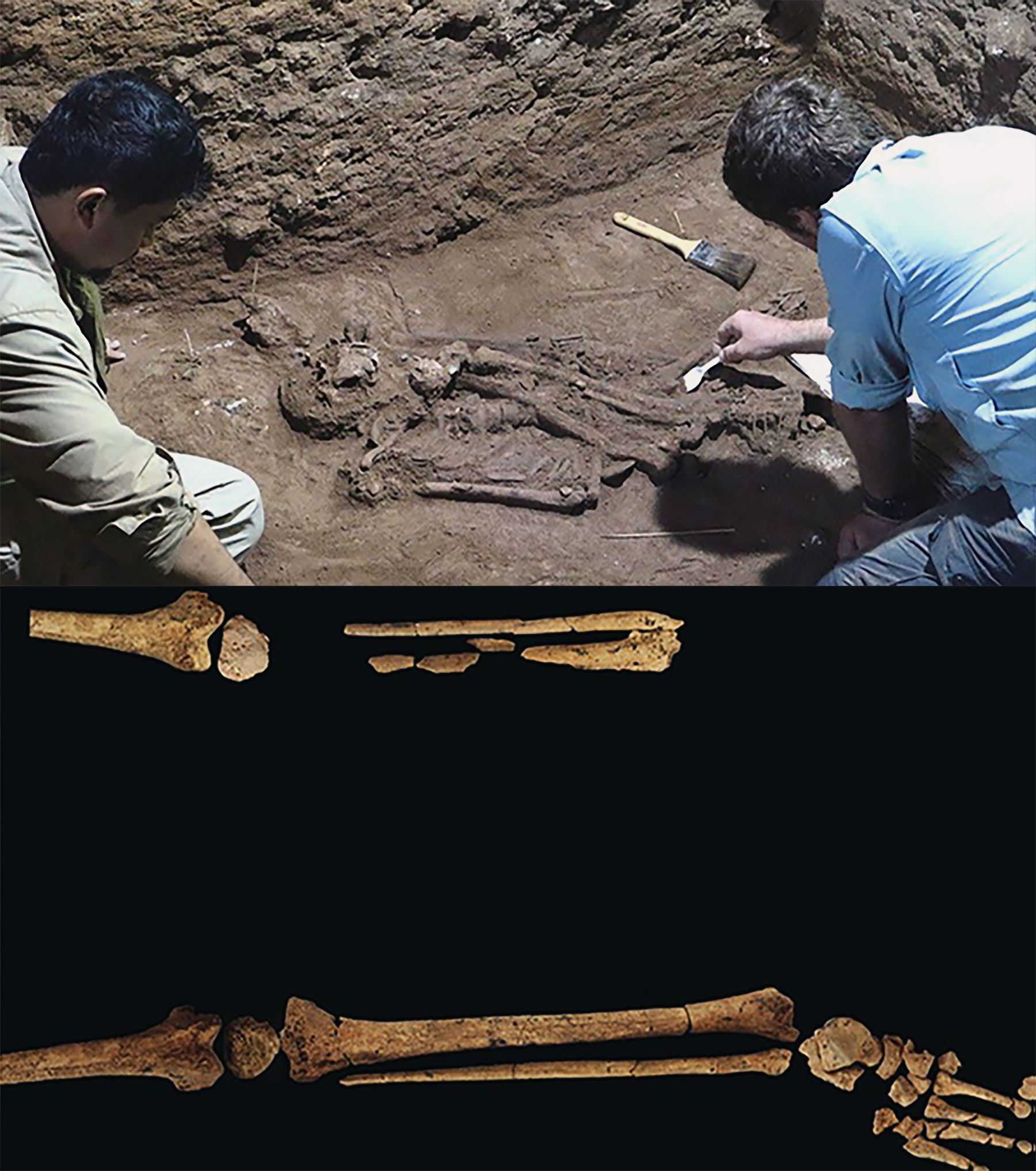 The earliest evidence ever of surgical amputation has been discovered in an Indonesian cave