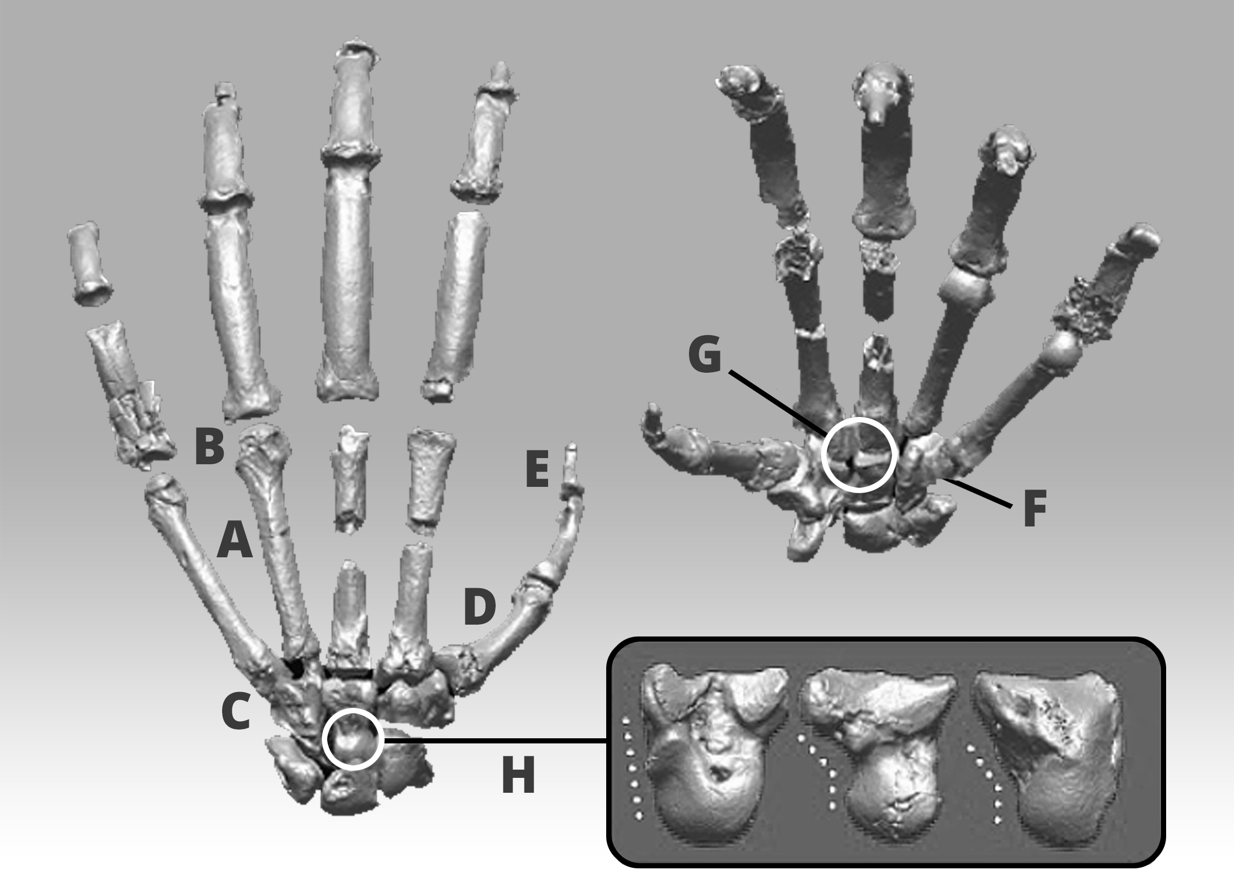 Prone and supine views of the left hand of Ardipithecus ramidus illustrating primitive features that don't appear in more specialized apes such as chimps.